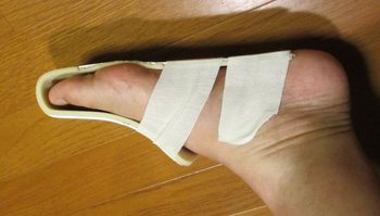 アルフェンス1.jpg