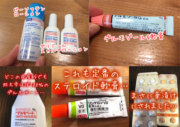 ローション リンデロン vg 【薬剤師が解説】リンデロンVG軟膏の効果・副作用と使い分け